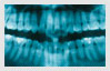 x-rays